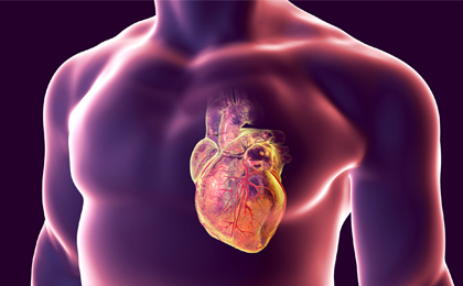 Cardiovascular - VTE